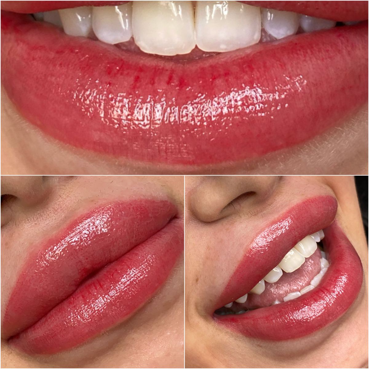 Healed lip blush from three angles