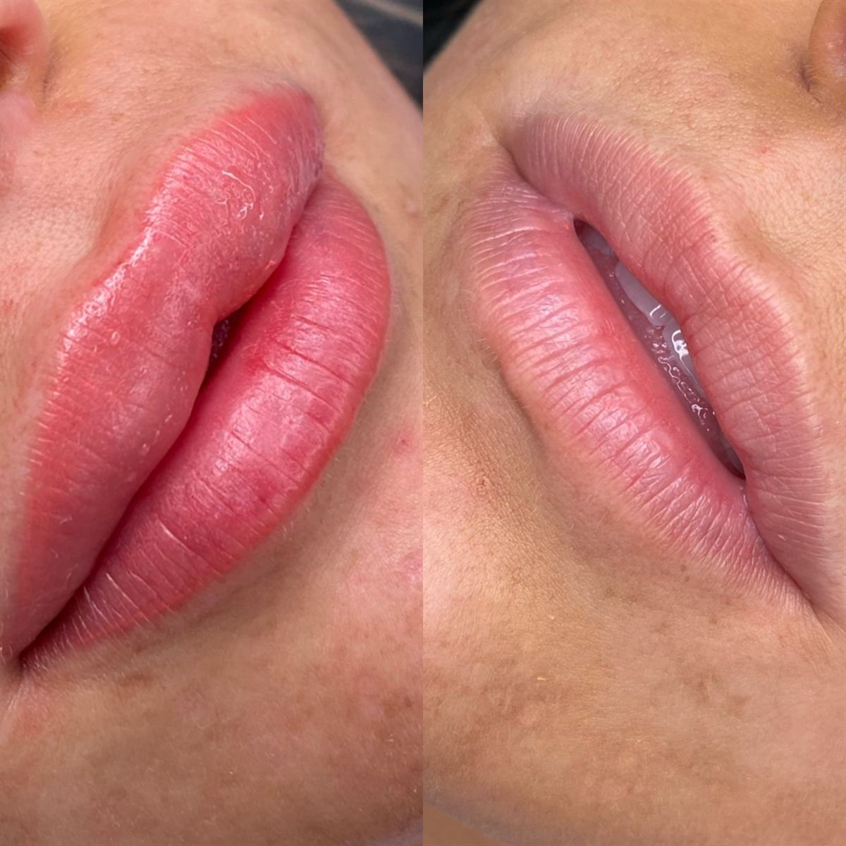 Lip blush before and after — soft rosy healed color