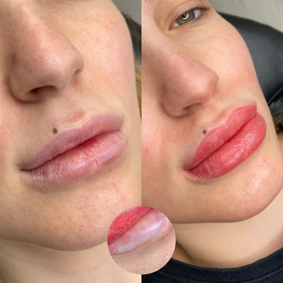 Lip blush transformation with procedure detail