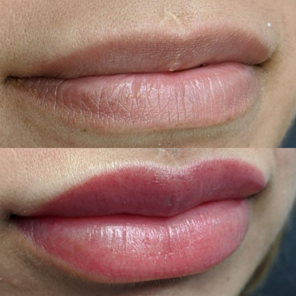 Healed lip neutralization — even rosy tone