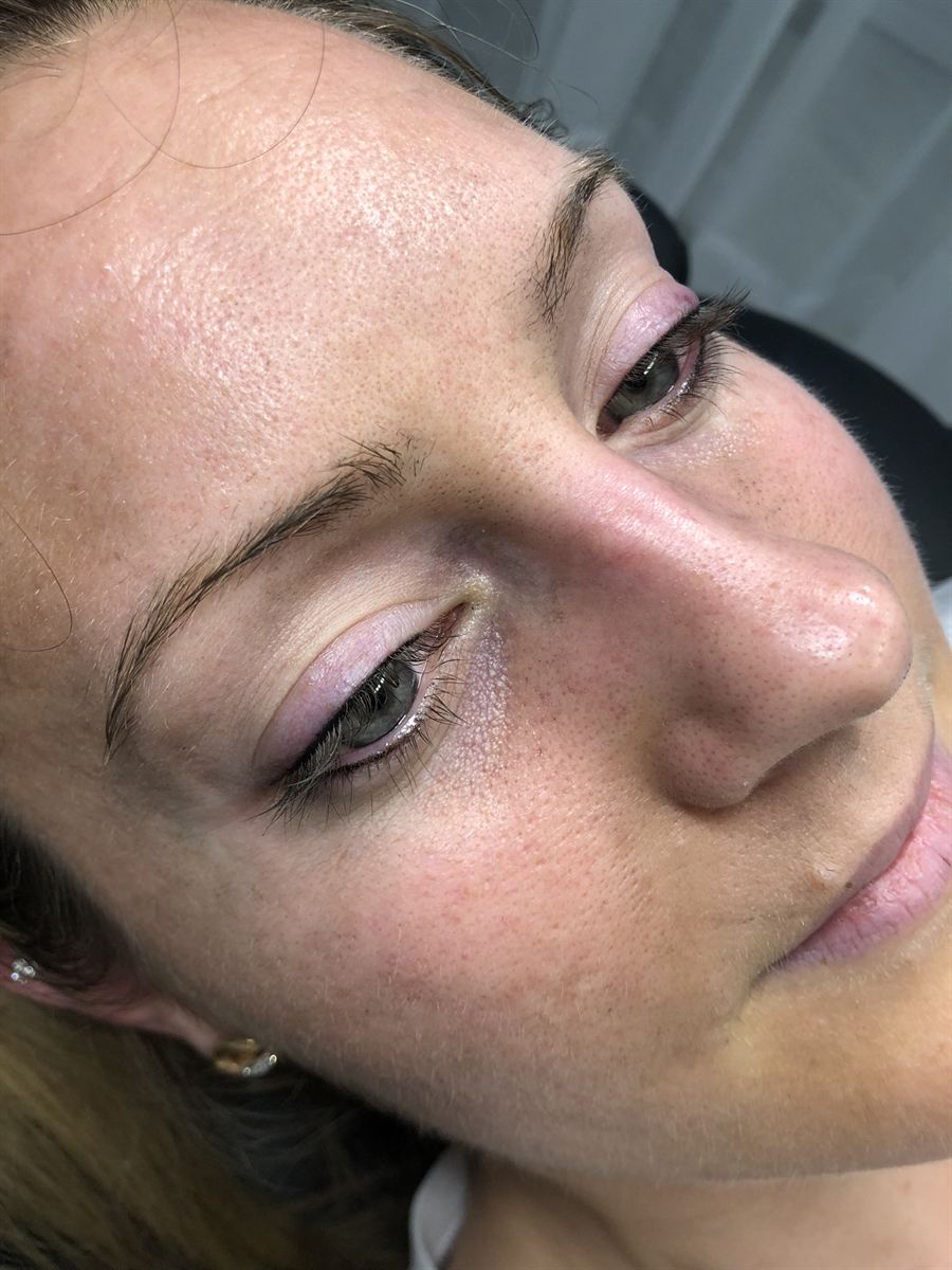 Invisible-makeup lash line enhancement result
